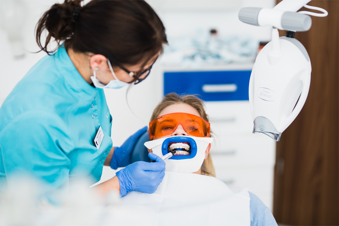 Bleichen der Zähne mit Bleichgel - mit niedriger Konzentration von Wasserstoffperoxid - auf die Zähne vor der Bestrahlung.